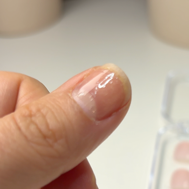 Posez les gel-pads adhésifs