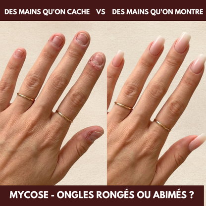 Rouge cerise - Carré Press On en Gel Souple